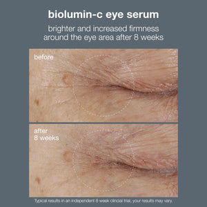 dermalogica biolumin-c vitamin C Eye Serum